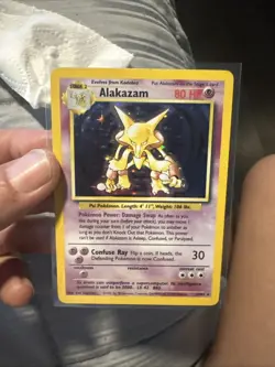 Alakazam 1/102 Holo Rare Base Set Pokemon Card WOTC | NM - Image 1