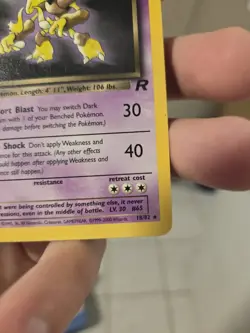 Dark Alakazam 18/82 1st Edition Team Rocket Rare Pokemon - Image 3