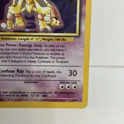 Alakazam 1/102 Base Set Holo Rare Vintage 1999 Pokemon Card - Image 4