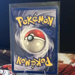 Pokemon Alakazam Base Set Shadowless 1st Edition Holo Rare Card 001/102 - Image 4