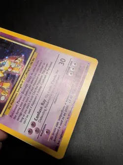 Pokemon TCG Alakazam Base Set Holo Card 1/102 Unlimited Rare Damaged - Image 3