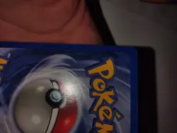 Pokemon Card 1st Edition Machamp Base Set Check Pics 🔥🔥🔥 - Image 5