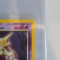 Pokemon Alakazam Base Set 1/102 80 HP Holo Rare English Card - Image 4