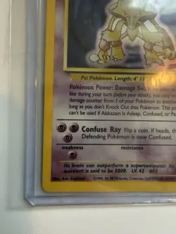 Pokemon Alakazam 1/102 Base Set Holo Rare English 1999 NEAR MINT 💎 - Image 5