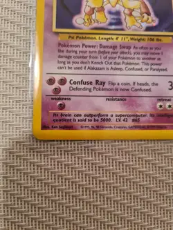 Pokemon Alakazam Card 1/102 Unlimited Holo Rare, Base Set - Image 4