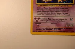 Pokemon Card Alakazam 1/102 Base Set Holo Rare WOTC Vintage - Image 5