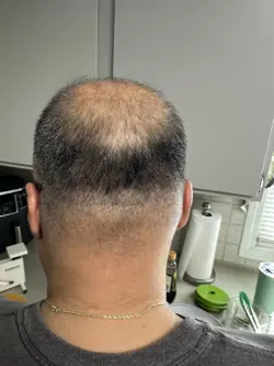 Yu-Gi-Oh! TOON WORLD HOLO 1st Edition MAGIC CARD MRL-076 LP! - Image 2