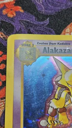 Pokemon Alakazam Base Set Shadowless Holo Rare 001/102- HP - Image 4
